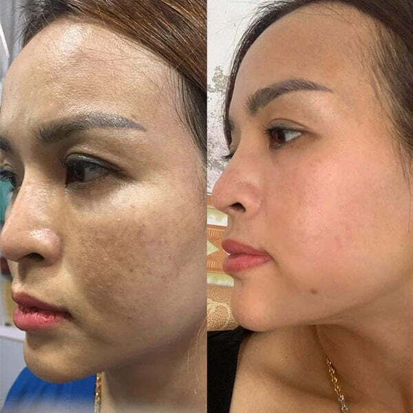 Feedback khách hàng có hiệu quả khi sử dụng mỹ phẩm Adonai Beauty Việt Nam 01 - Adonai Viet Nam